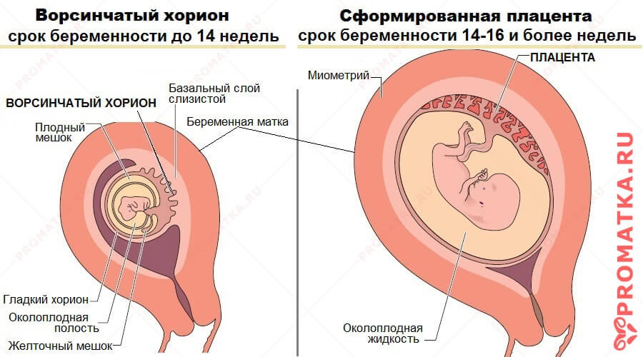 Ворсинчатый хорион и плацента