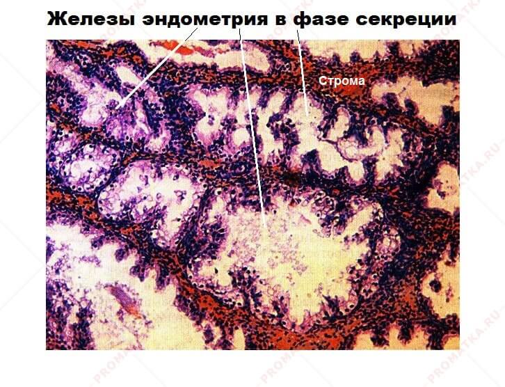 Железы эндометрия в фазе секреции